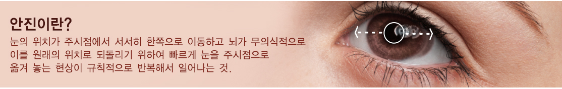 안진이란? 눈의 위치가 주시점에서 서서히 한쪽으로 이동하고 뇌가 무의식적으로 이를 원래의 위치로 되돌리기 위하여 빠르게 눈을 주시점으로 옮겨 놓는 현상이 규칙적으로 반복해서 일어나는 것.