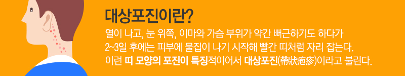 대상포진이란? 뻐근하다가 2~3일 후에 피부에 물집이 나기 시작해 빨간 띠처럼 자리 잡아 띠 모양의 포진이 특징적이어서 대상포진이라 불린다