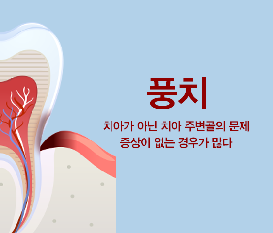 풍치. 치아가 아닌 치아 주변골의 문제 증상이 없는 경우가 많다.