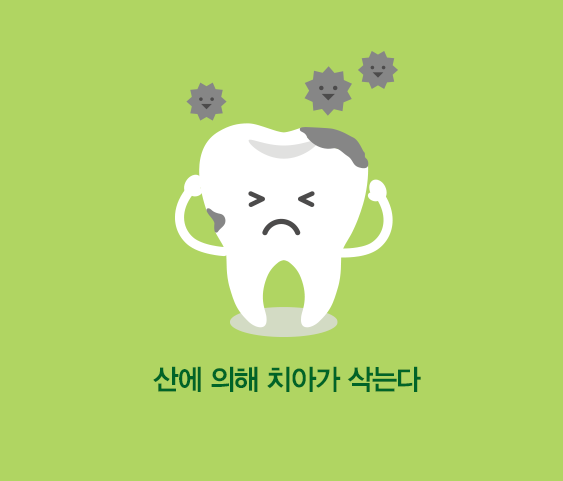 치아우식증의 원인2. 산에 의해 치아가 삭는다.