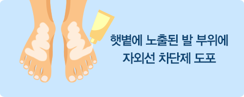 햇볕에 노출된 발 부위에 자외선 차단제 도포