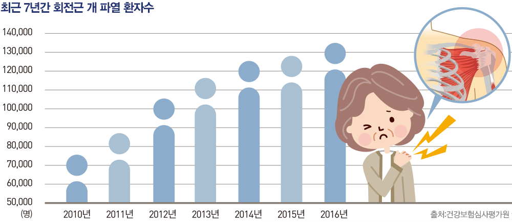 최근 7년간 회전근 개 파열 환자수 2010년 75,000명, 2011년 83,000명, 2012년 105,000명, 2013년 115,000원, 2014년 125,000명, 2015년 126,00명, 2016년 133,000명.