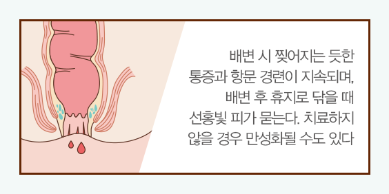 치열의 설명과 이미지