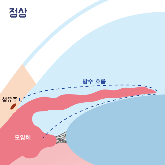 정상인의 방수의 흐름