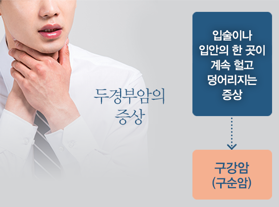 두경부암의 증상:  구강암(구순암) - 입술이나 입안의 한곳이 계속 헐고 덩어리지는 증상