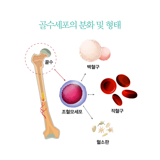 골수 세포의 분화 및 형태 골수 백혈구 조혈모세포 적혈구 혈소판