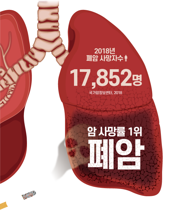 폐암 통계