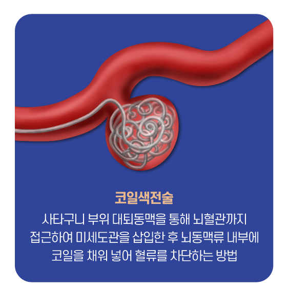 코일색전술