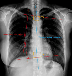 유방 재건의 장점 (안내 리플렛)