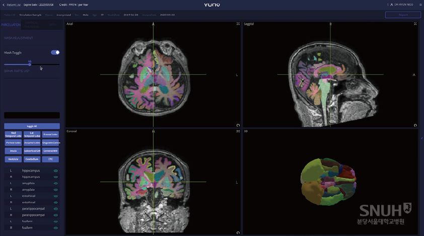 딥러닝을 포함한 인공지능 기술을 활용, 뇌 MRI 영상을 분석해 치매 및 인지장애를 평가할 수 있는 소프트웨어 