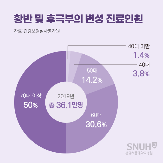 황반 및 후극부의 변성 진료인원(자료 : 건강보험심사평가원. 40세 미만 - 1.4%, 40대 - 3.8%, 50대 - 14.2%, 60대 - 30.6%, 70대 이상 - 50%