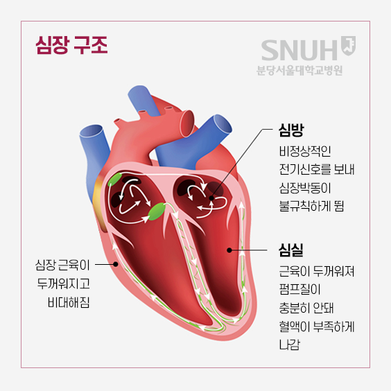 심장 구조 : 심방- 비정상적인 전기신호를 보내 심장박동이 불규칙하게 뜀, 심실- 근육이 두꺼워져 펌프질이 충분히 안돼 혈액이 부족하게 나감. 심장 근육이 두꺼워지고 비대해짐