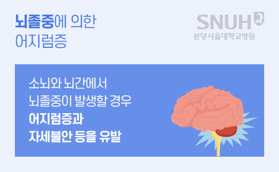 뇌졸중에 의한 어지럼증: 소뇌와 뇌간에서 뇌졸중이 발생할 경우 어지럼증과 자세불안 등을 유발. 