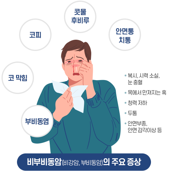 비부비동암의 주요증상 : 안면통치통, 콧물 후비루, 코피, 코 막힘, 부비동염. 복시, 시력 소실, 눈 충혈, 목에서 만져지는 혹, 청력 저하, 두통 , 안면부종, 안면 감각이상 등.