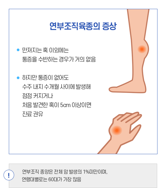 연부조직육종의 증상. 만져지는 혹 이외에는 통증을 수반하는 경우가 거의 없음. 하지만 통증이 없어도 수주 내지 수개월 사이에 발해 점점 커지거나 처음 발견한 혹이 5cm이상이면 진료 권유. 연부조직 종양은 전체 암 발생의 1%미만이며, 연령대별로는 60대가 가장 많음