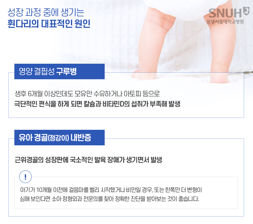 성장 과정 중에 생기는 휜다리의 대표적인 원인. 영양 결핍성 구루병: 생후 6개월 이상인데도 모유만 수유하거나 아토피 등으로 극단적인 편식을 하게 되면 칼슘과 비타미D의 섭취가 부족해 발생. 유아경골(정강이)내반증 : 근위경골의 성장판에 국소적인 발육 장애가 생기면서 발생. 아이가 10개월 이전에 걸음마를 빨리 시작했거나 비만일 경우, 도는 한쪽만 더 변형이 심해 보인다면 소아 정형외과 전문의를 찾아 정확한 진단을 받아보는 것이 좋습니다. 