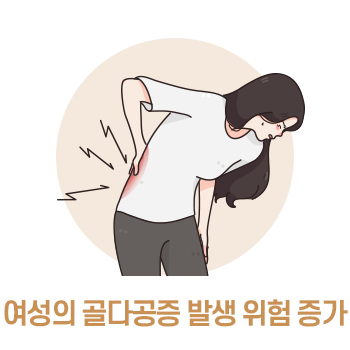 여성의 골다공증 발생 위험 증가