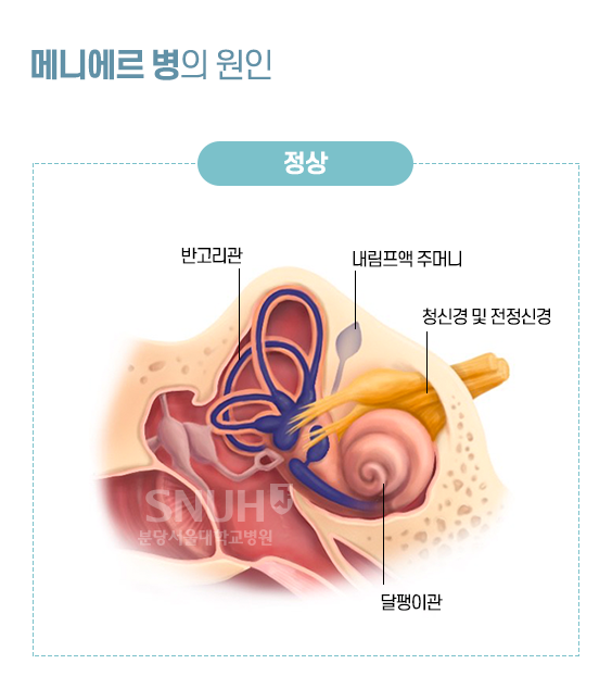 메니에르병의 원의, 정상 구조 - 반고리관, 내림프액 주머리, 청신경 및 전정신경, 달팽이관