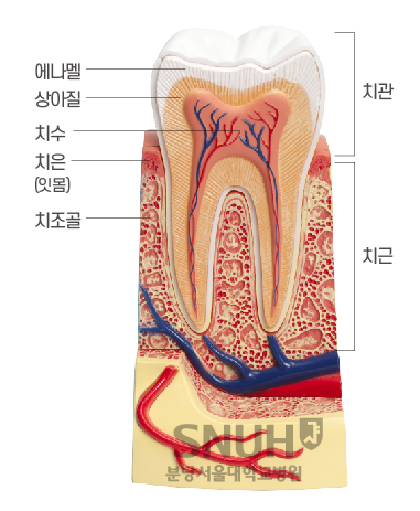 치아단면 : 치관-에나멜, 상아질, 치주, 치근-치은(잇몸), 치조골