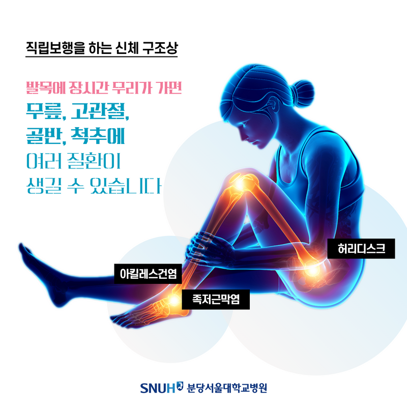 직립보행을 하는 신체 구조상. 발목에 장시간 무리가 가면 무릎, 고관절, 골반, 척추에 여러 질환이 생길 수 있습니다.