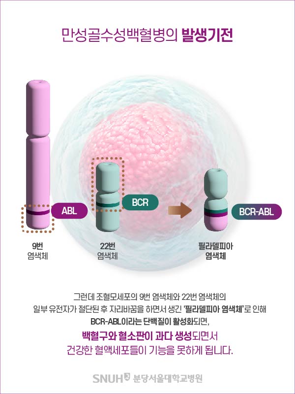 만성골수성백혈병의 발생기전