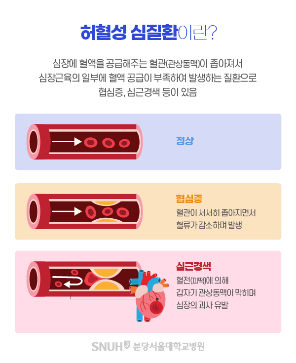 허혈성 심질환의 정의