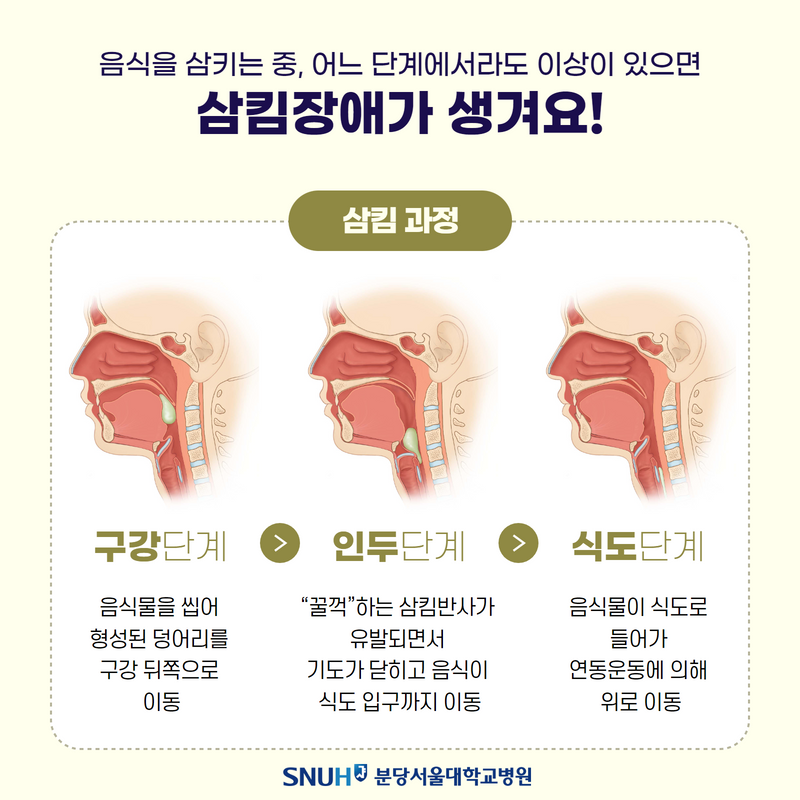 삼킴과정 일러스트