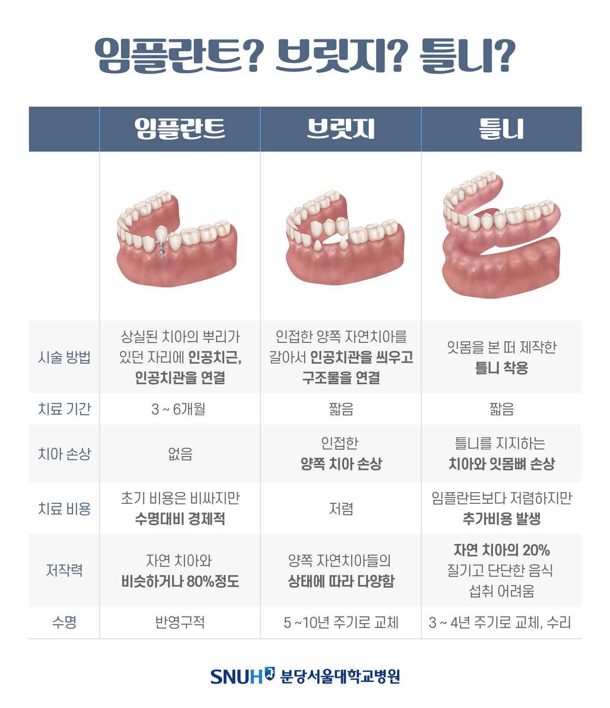 임플란트, 브릿지, 틀니 비교:임플란트.시술방법 : 상실된 치아의 뿌리가 있던 자리에 인공치근, 인공치관을 연결.치료기간 : 3~6개월.치아손상 : 없음.치료비용 : 초기 비용은 비싸지만 수명대비 경제적.저작력 : 자연 치아와 비슷하거나 80%정도.수명 : 반영구적.브릿지.시술방법 : 인접한 양쪽 자연치아를 갈아서 인공치관을 씌우고 구조물을 연결.치료기간 : 짧음.치료손상 : 인접한 양쪽 치아 손상.치료비용 : 저렴.저작력 : 양쪽 자연치아들의 상태에 따라 다양함.수명 : 5~10년 주기로 교체.틀니.시술방법 : 잇몸을 본 떠 제작한 틀니 착용.치료기간 : 짧음.치료손상 : 틀니를 지지하는 치아와 잇몸뼈 손상.치료비용 : 임플란트보다 저렴하지만 추가비용 발생.저작력: 자연 치아의 20% 질기고 단단한 음식 섭취 어려움.수명 : 3~4년 주기로 교체 , 수리.