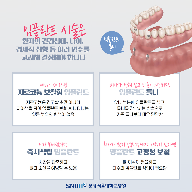 임플란트 시술 종류
