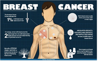 breast cancer in men