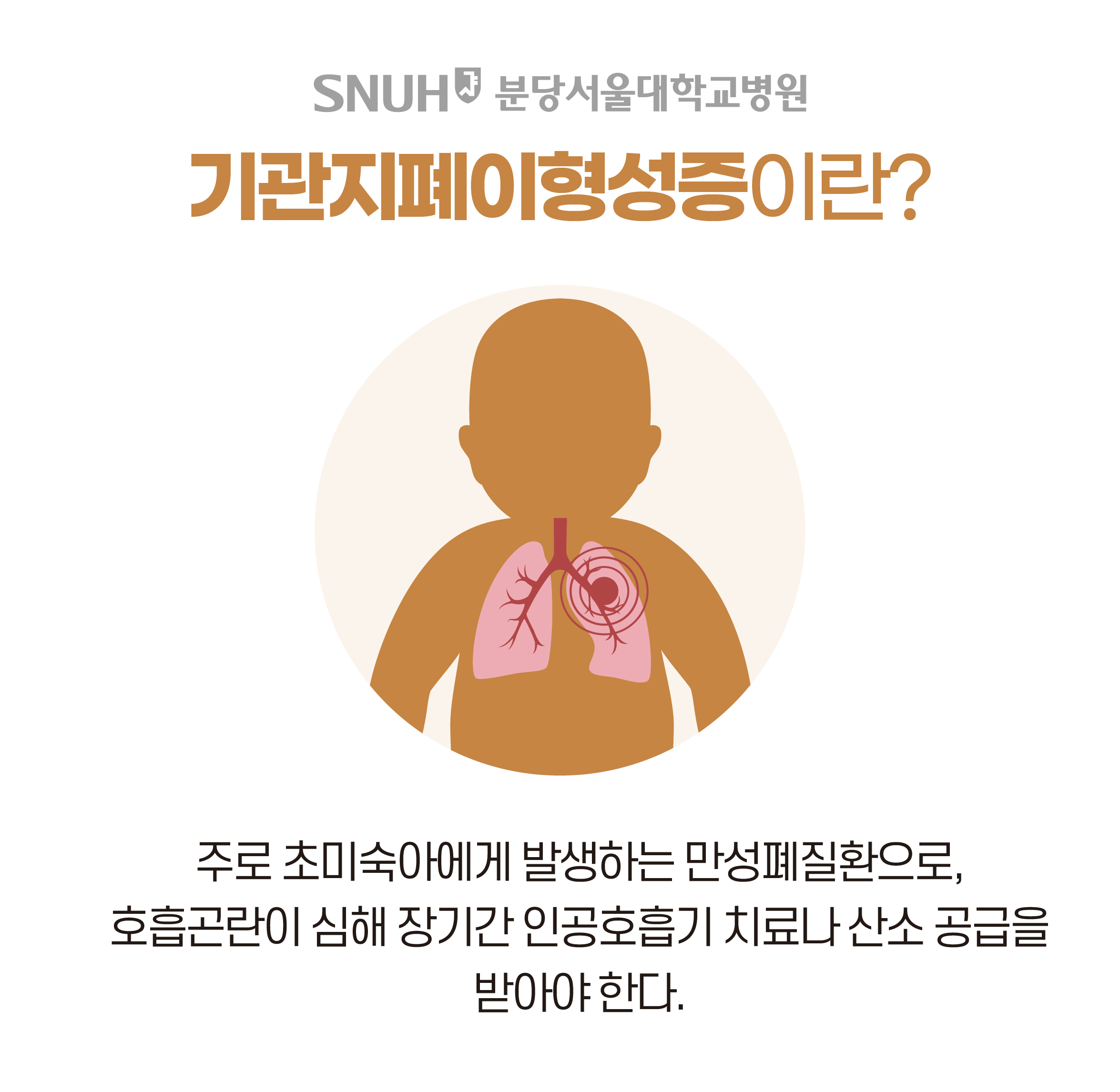 기관지폐이형성증이란? 주로 초미숙아에게 발생하는 만성폐질환으로, 호흡곤란이 심해 장기간 인공호흡기 치료나 산소 공급을 받아야 한다.