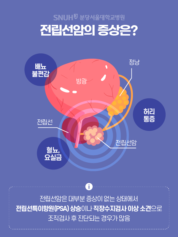 전립선암의 증상