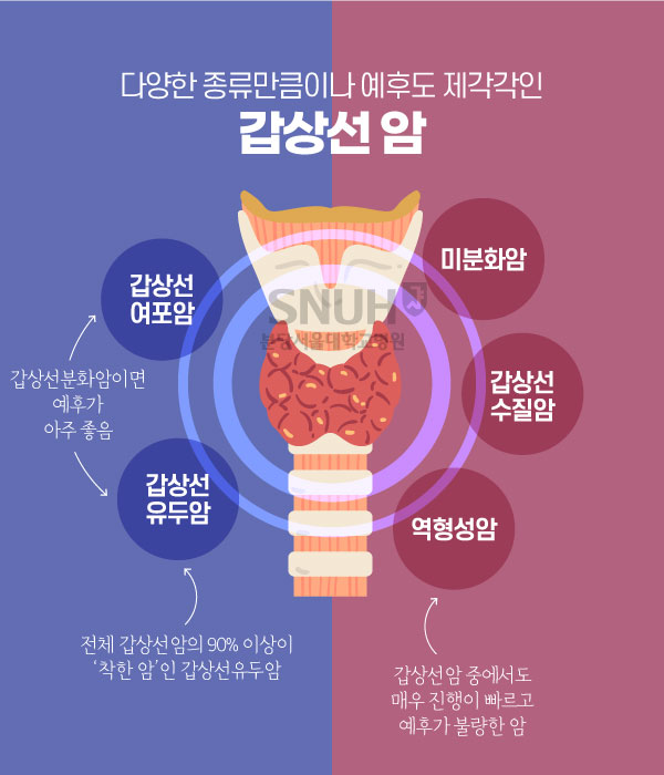 다양한 종류만큼이나 예후도 제각각인 갑상선 암 갑상선 여포암 및 갑상선 유두암: 갑상선 분화임이면 예후가 매우 좋음 갑상선 유두암: 전체 갑상선암의 90% 이상이 '착한 암'인 갑상선유두암 미분화암, 갑상선 수질암, 역형성암 역형성암: 갑상선암 중에서도 매우 진행이 빠르고 예후가 불량한 암