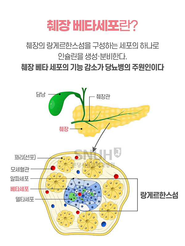 췌장 베타세포란? 췌장의 랑게르한스섬을 구성하는 세포의 하나로 인슐린을 생성·분비한다. 췌장 베타 세포의 기능 감소가 당뇨병의 주원인이다. -담낭 췌장관 췌장 꽈리(선포) 모세혈관 알파세포 베타세포 델타세포 랑게르한스섬 