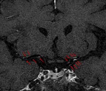 external_image
