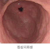 장상피화생