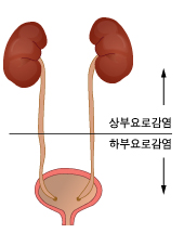 혈뇨의 원인은 무엇인가요