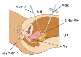 contimg8_64.jpg 진단 방법