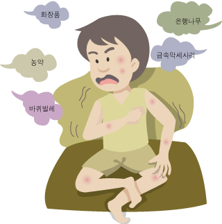 두드러기원인1