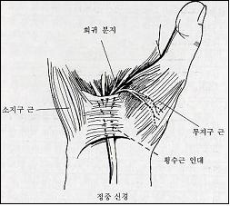 수근관을 통과하는 정중신경
