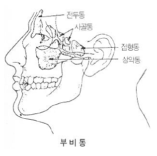 내시경 부비들수술