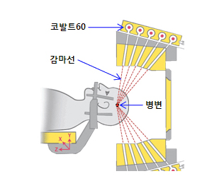 감마나이프 원리