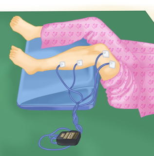 02_32.jpg 전기자극치료