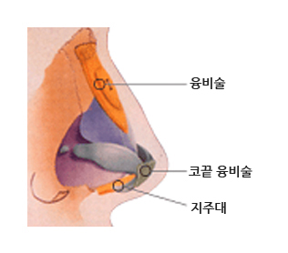 낮은 코(융비술)