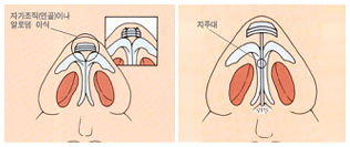 코끝높임