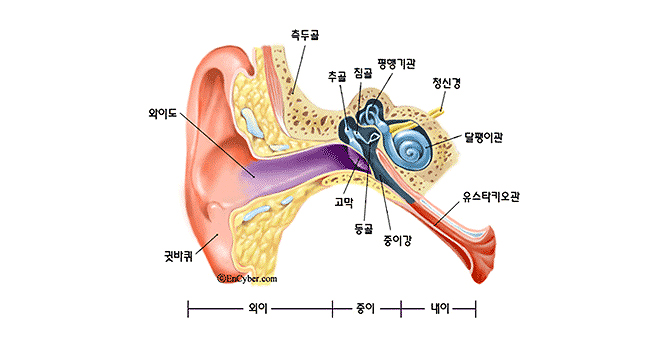 난청이란