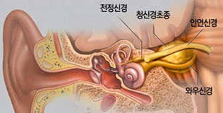 전정신경,청신경초종,안면신경,와우신경