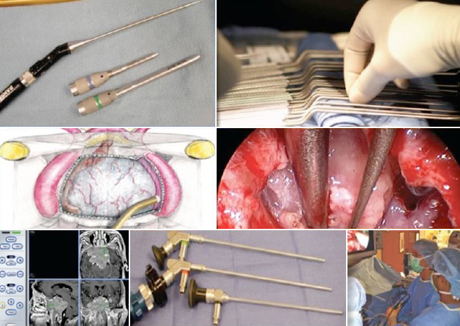 내시경 뇌수술에 사용되는 기구들