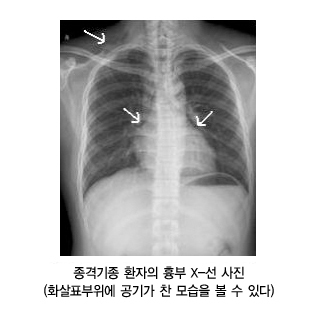 진단1