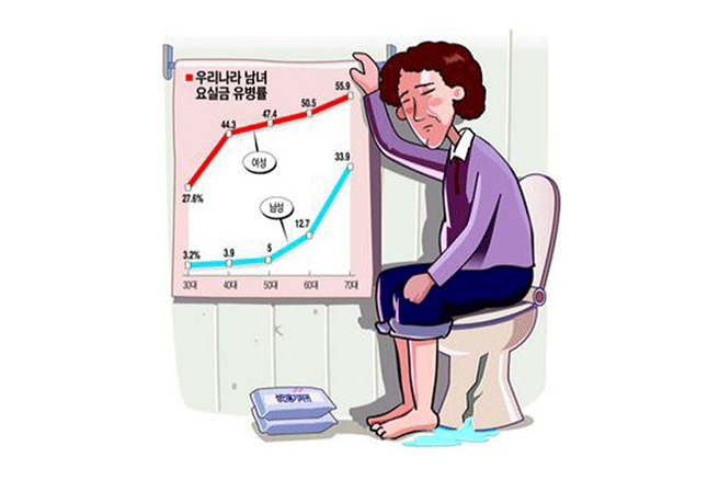 여성의 약 40%가 요실금을 경험 